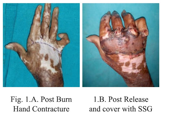 Patna journal of Medicine
