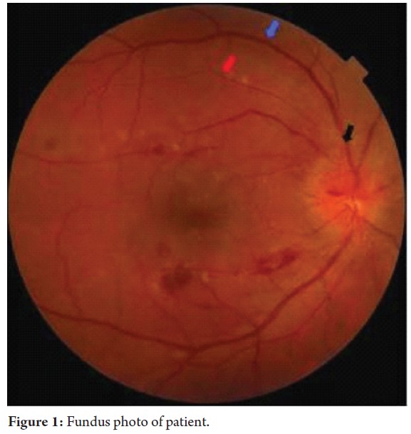 Fundus