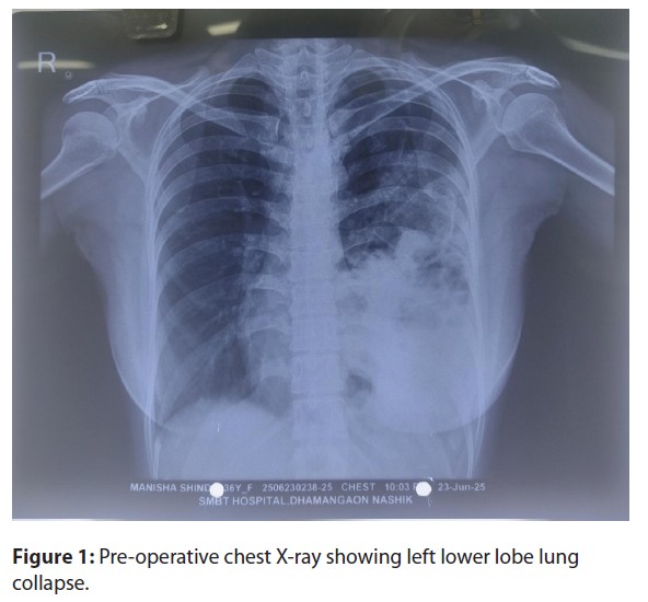 X-ray