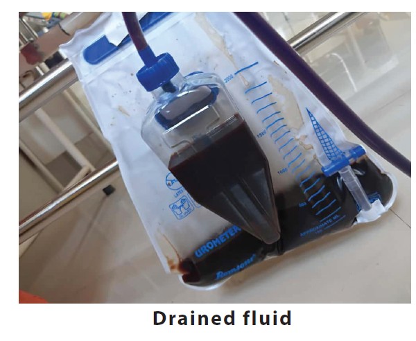 Fluid