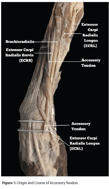 Accessory Tendon