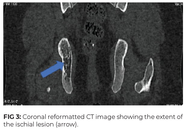 CT image